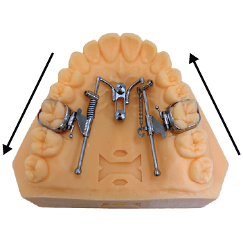 hdc-ortho-mesialdistal-a